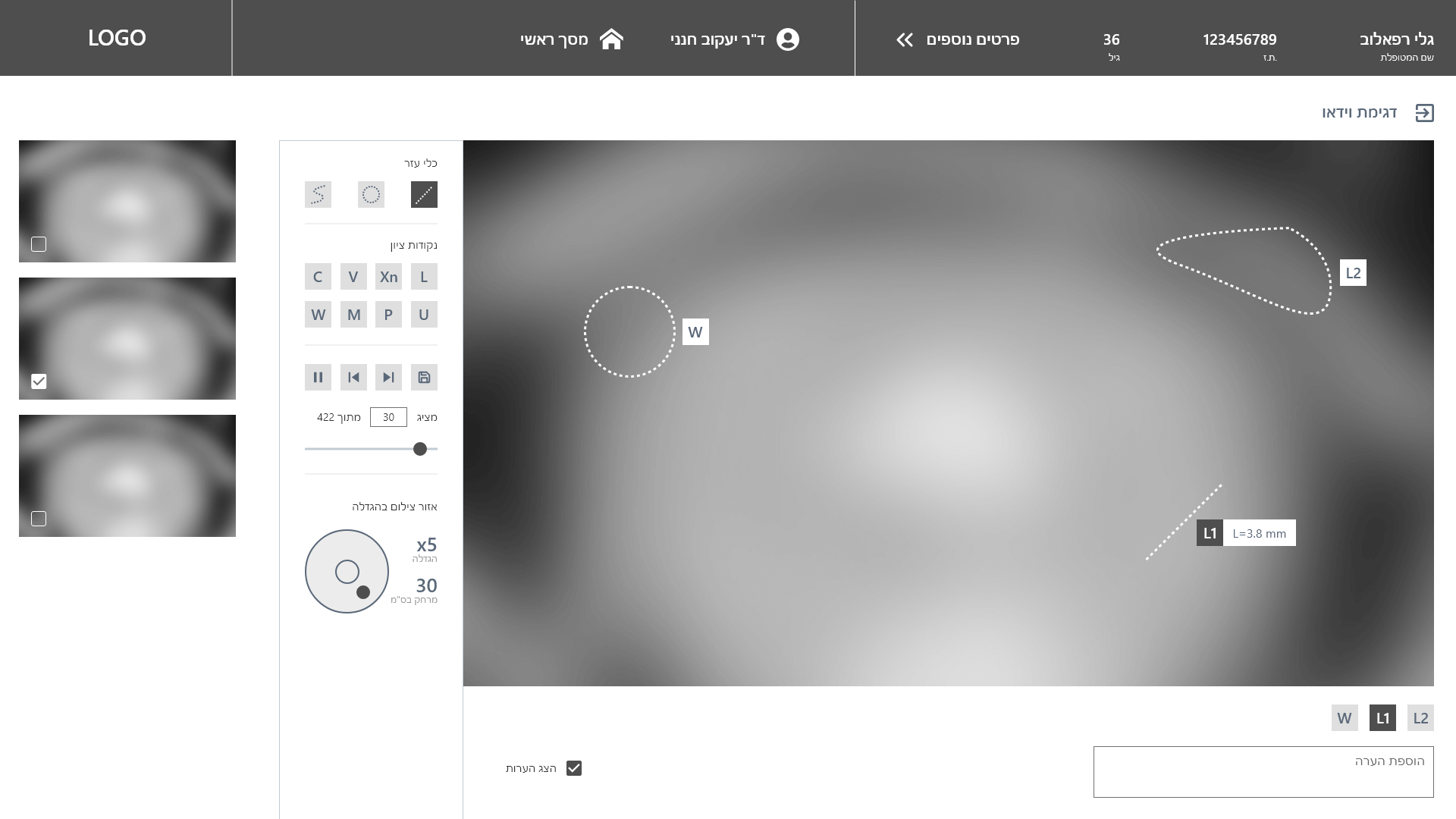 Colposcope app