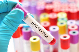 Gloved hand holding a blood sample vial labeled 'HbA1c - Test' with colorful test tubes blurred in the background.