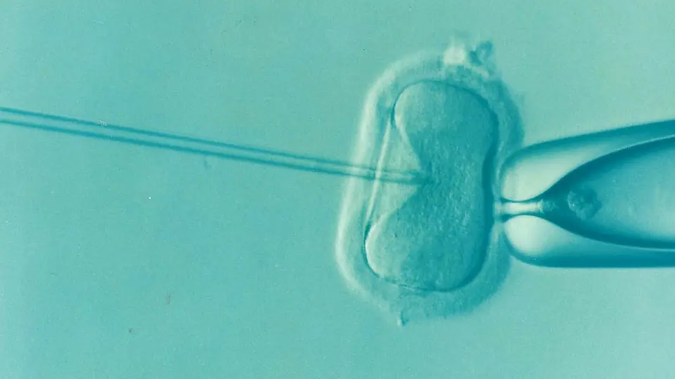 image of IVF procedure