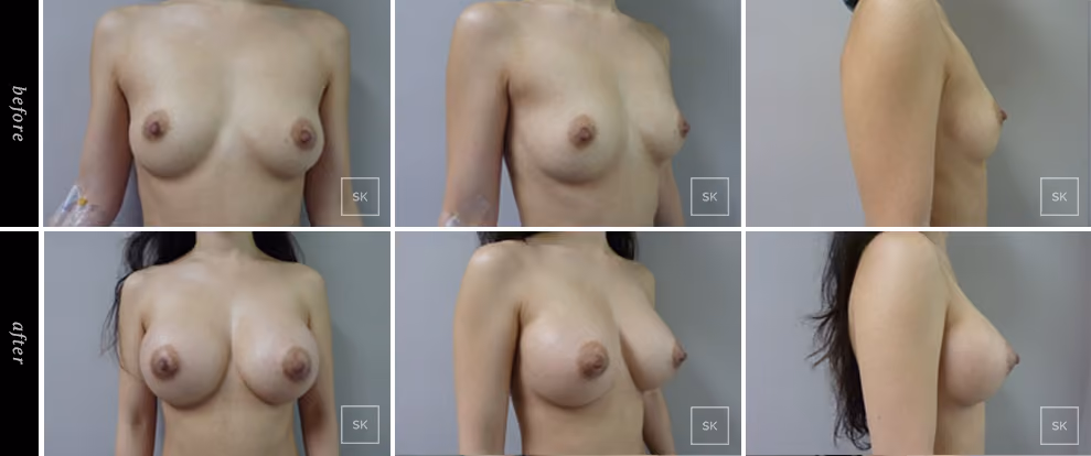 Before & After Photo Gallery