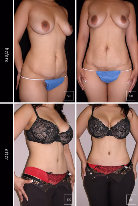 Before & After Photo Gallery