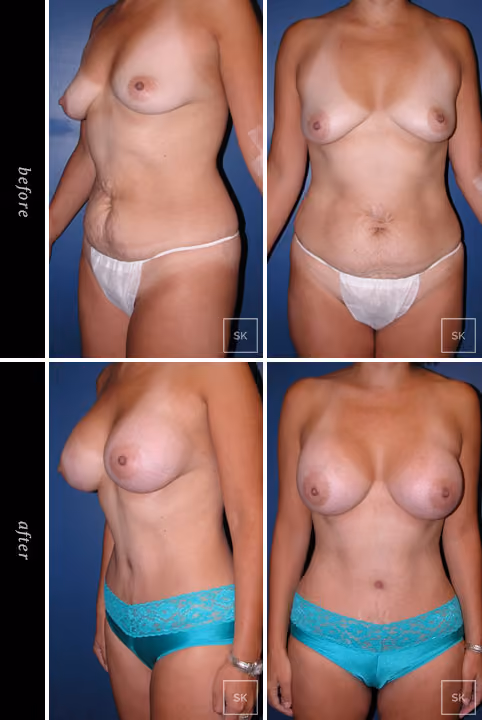 Before & After Photo Gallery