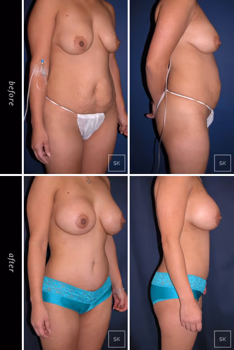 Before & After Photo Gallery