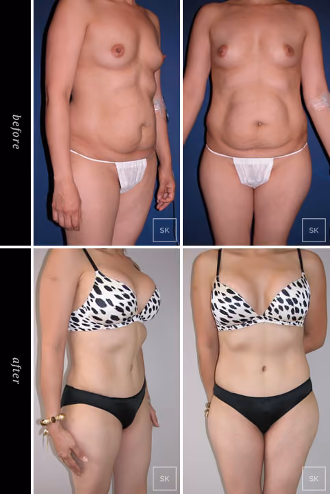 Before & After Photo Gallery