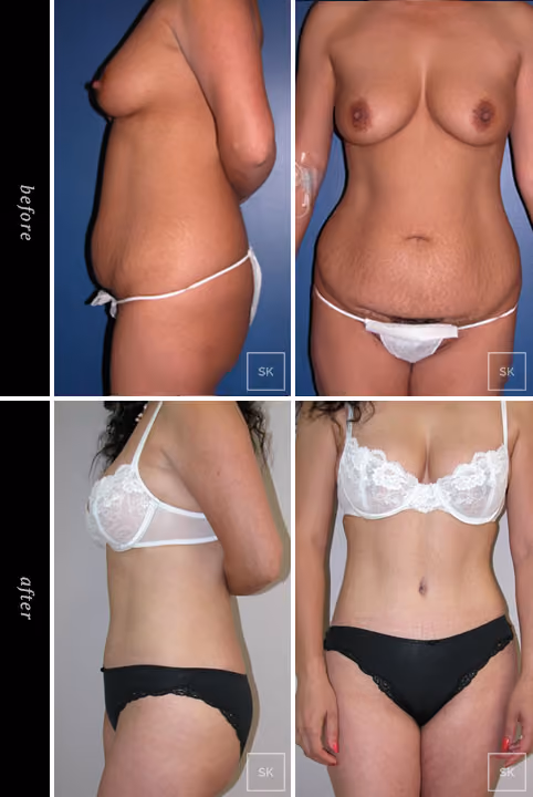 Before & After Photo Gallery