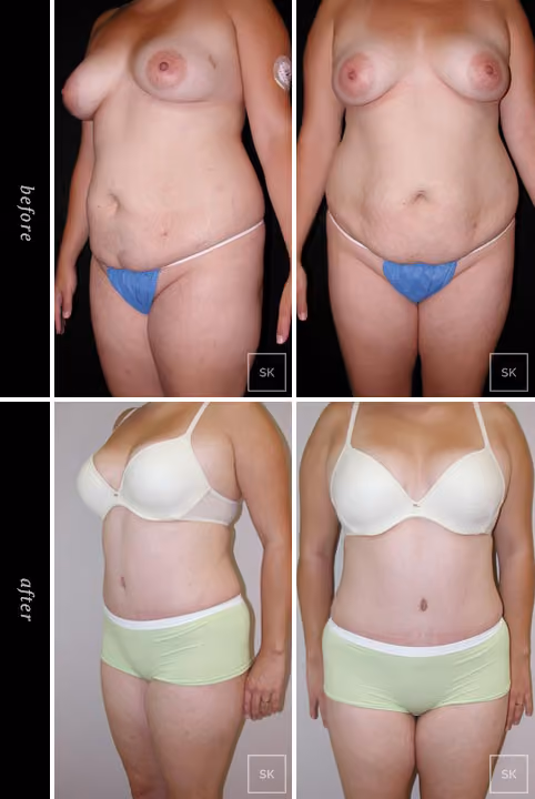 Before & After Photo Gallery