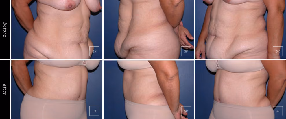  Before & After Photo Gallery