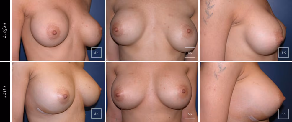  Before & After Photo Gallery