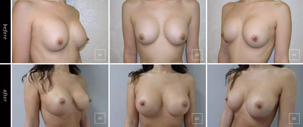  Before & After Photo Gallery