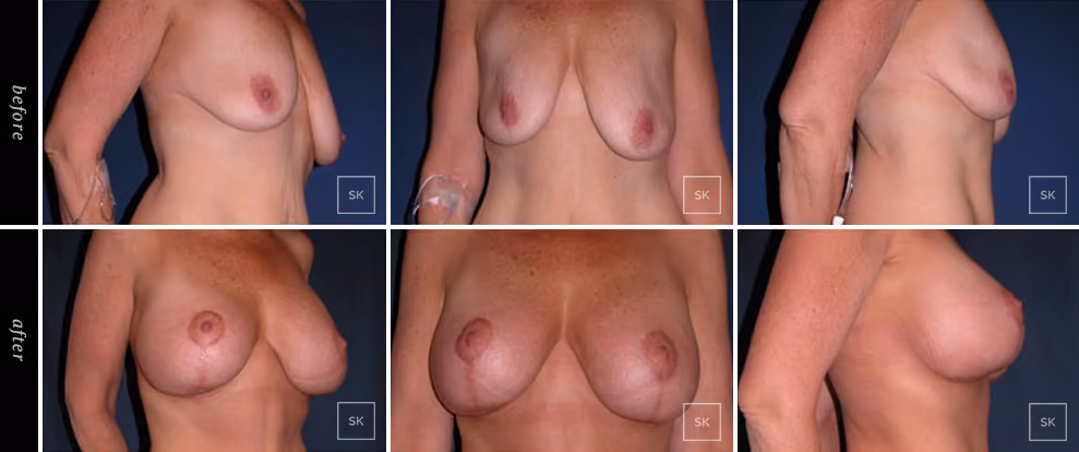 Before & After Photo Gallery