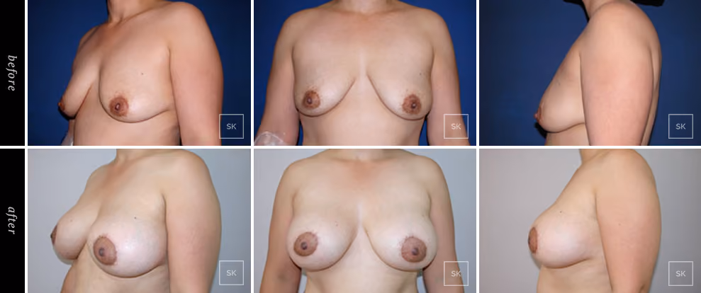 Before & After Photo Gallery