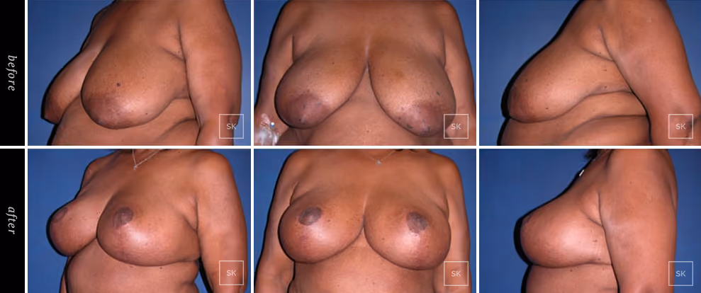 Before & After Photo Gallery