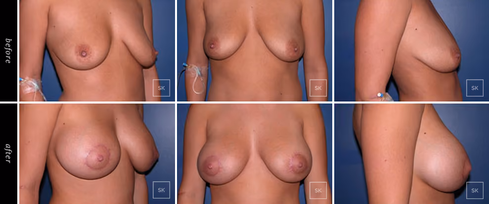 Before & After Photo Gallery