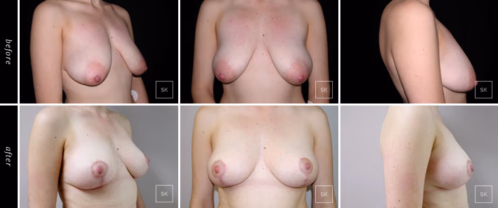 Before & After Photo Gallery