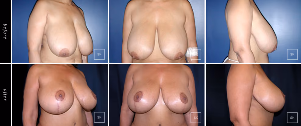 Before & After Photo Gallery