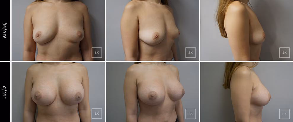 Before & After Photo Gallery