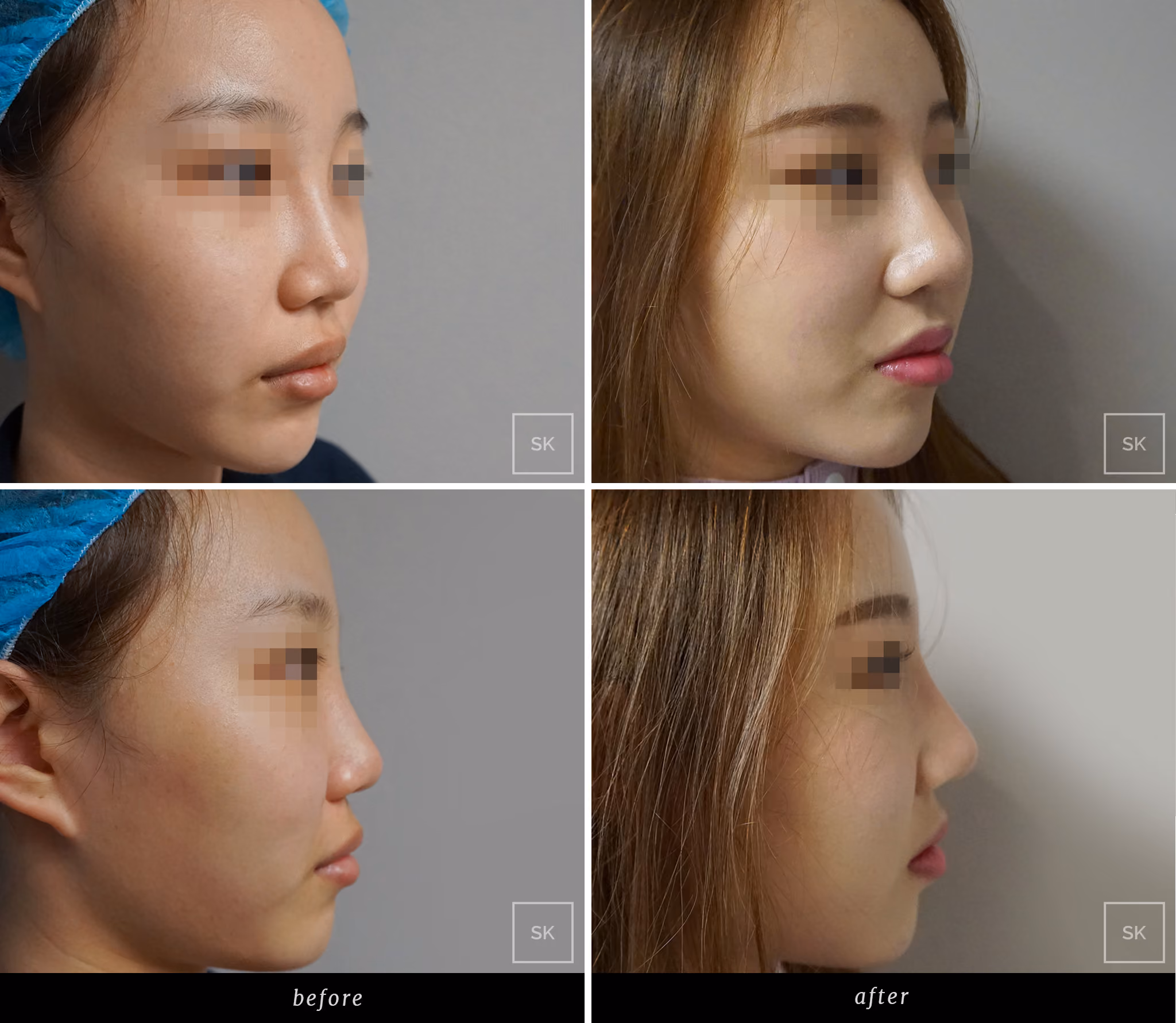 Before & After Photo Gallery