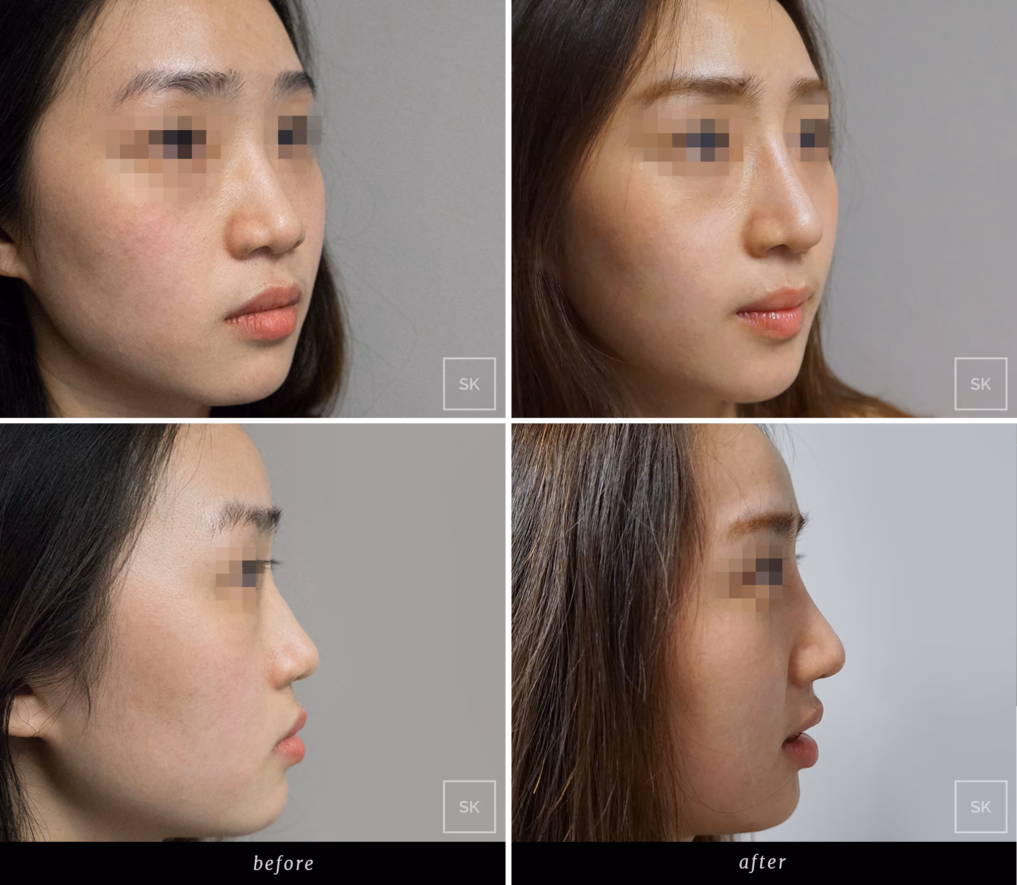Before & After Photo Gallery
