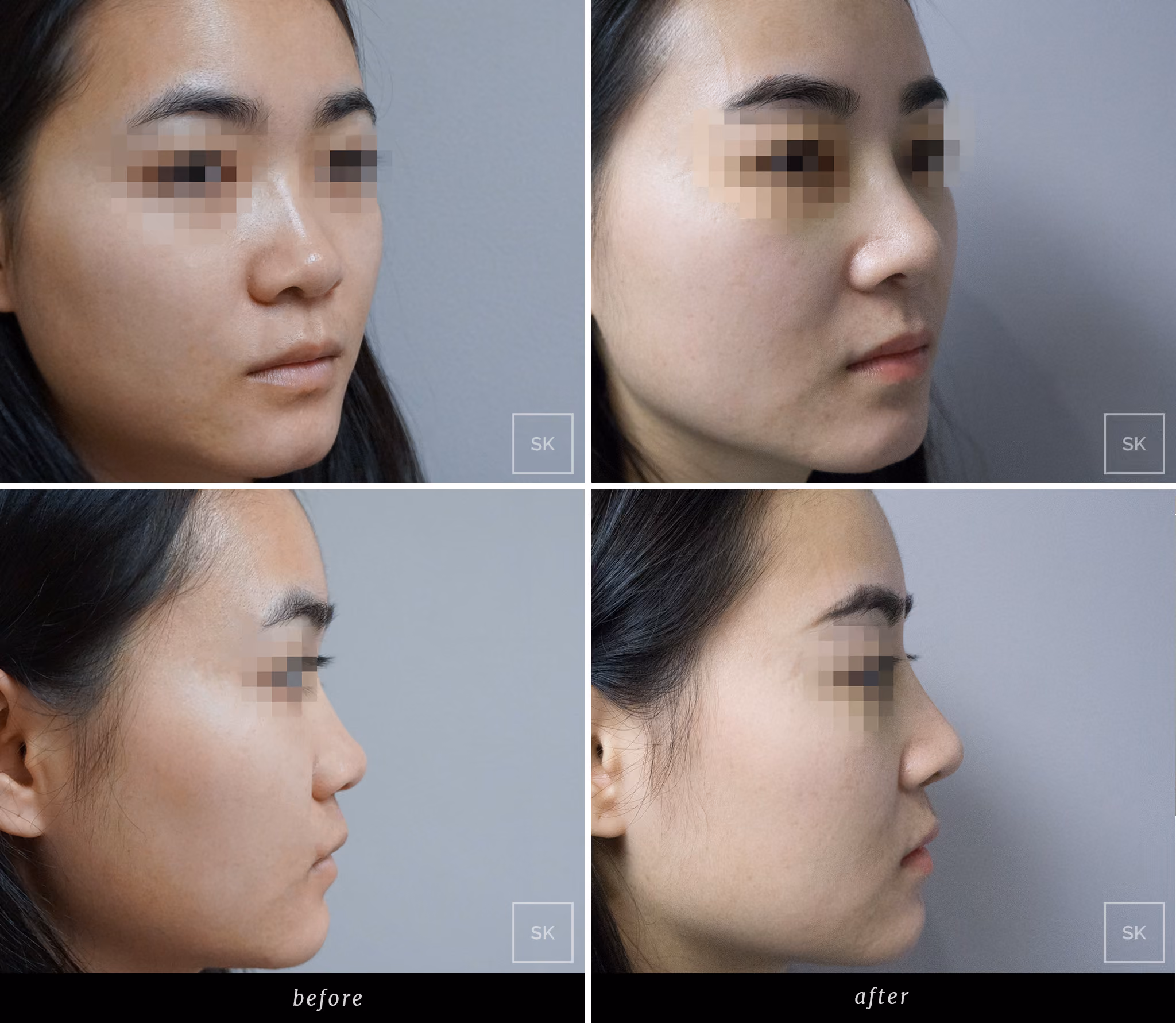 Before & After Photo Gallery