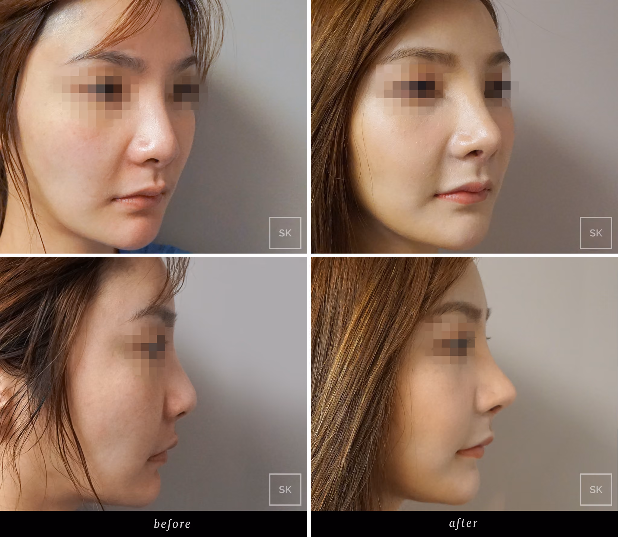 Before & After Photo Gallery