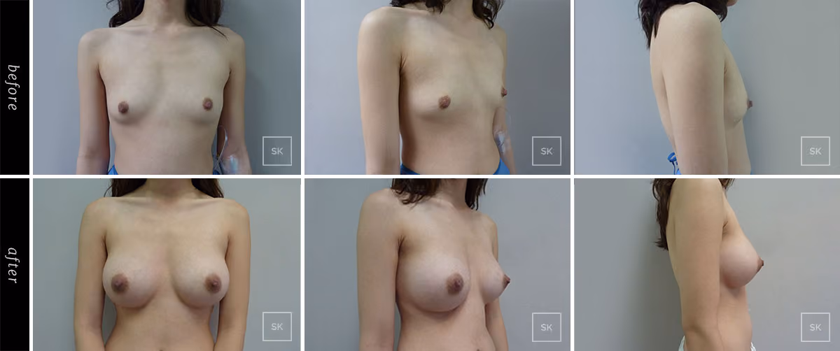 Before & After Photo Gallery