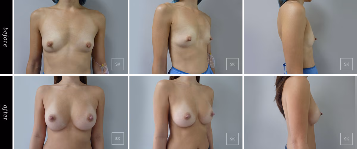 Before & After Photo Gallery