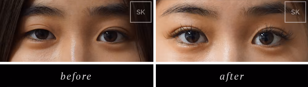 Before & After Photo Gallery