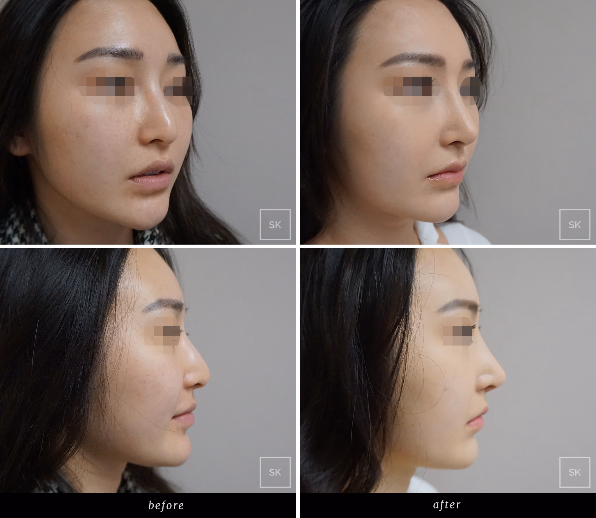 Before & After Photo Gallery