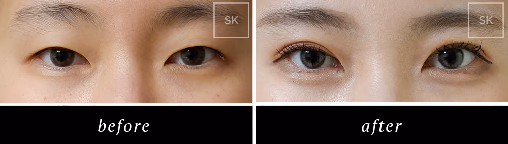Before & After Photo Gallery