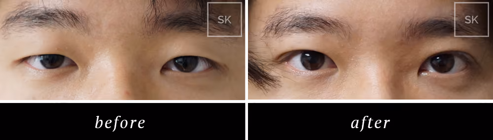 Before & After Photo Gallery