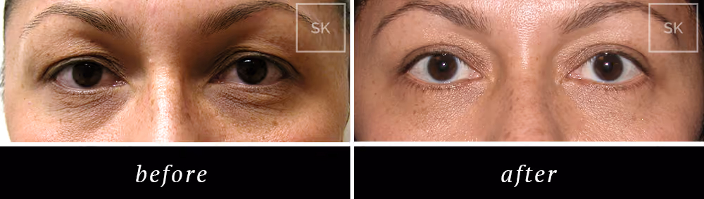 Before & After Photo Gallery