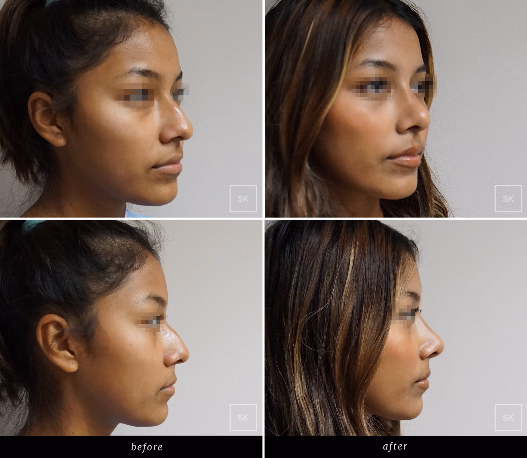 Before & After Photo Gallery