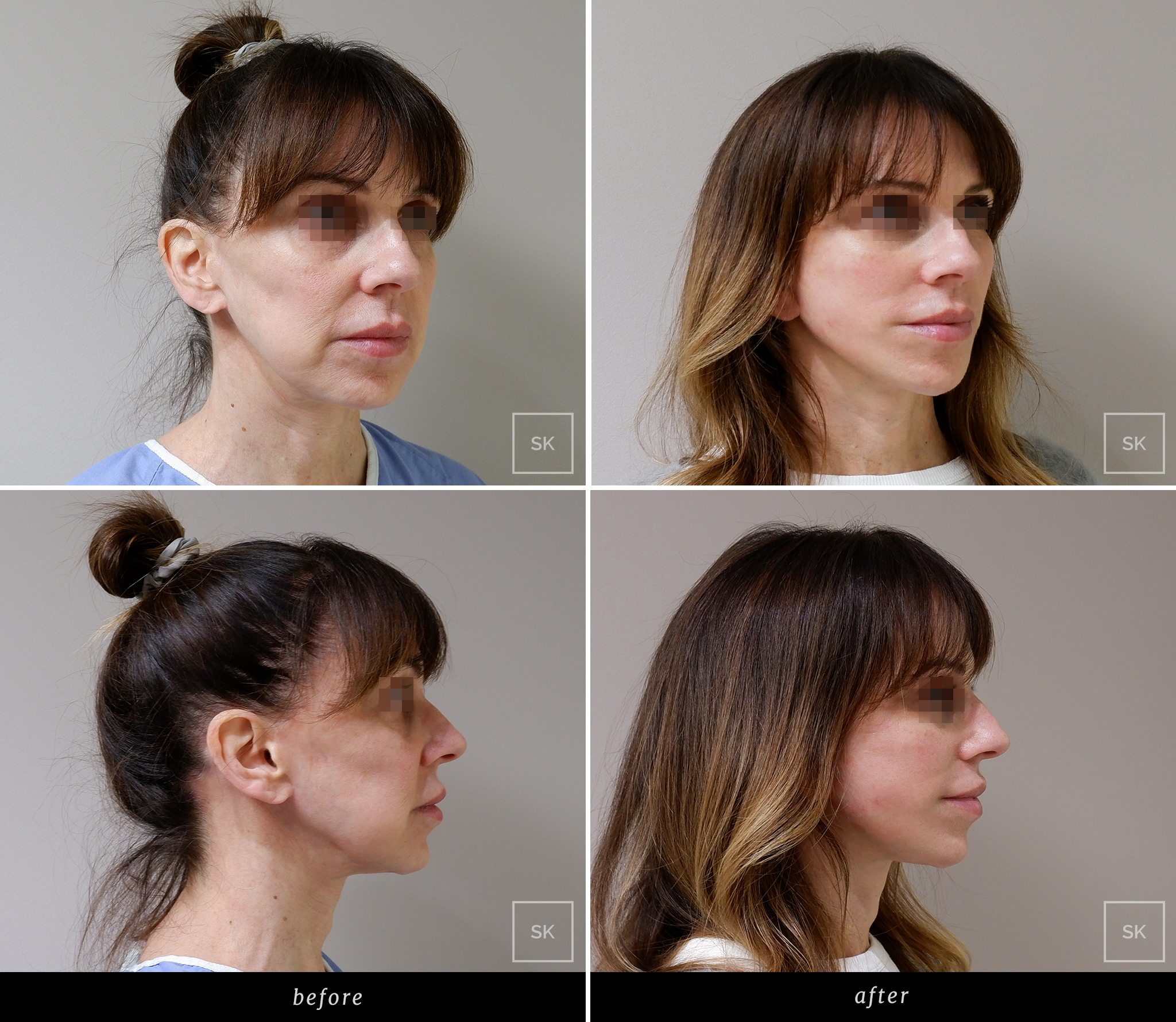 Before & After Photo Gallery