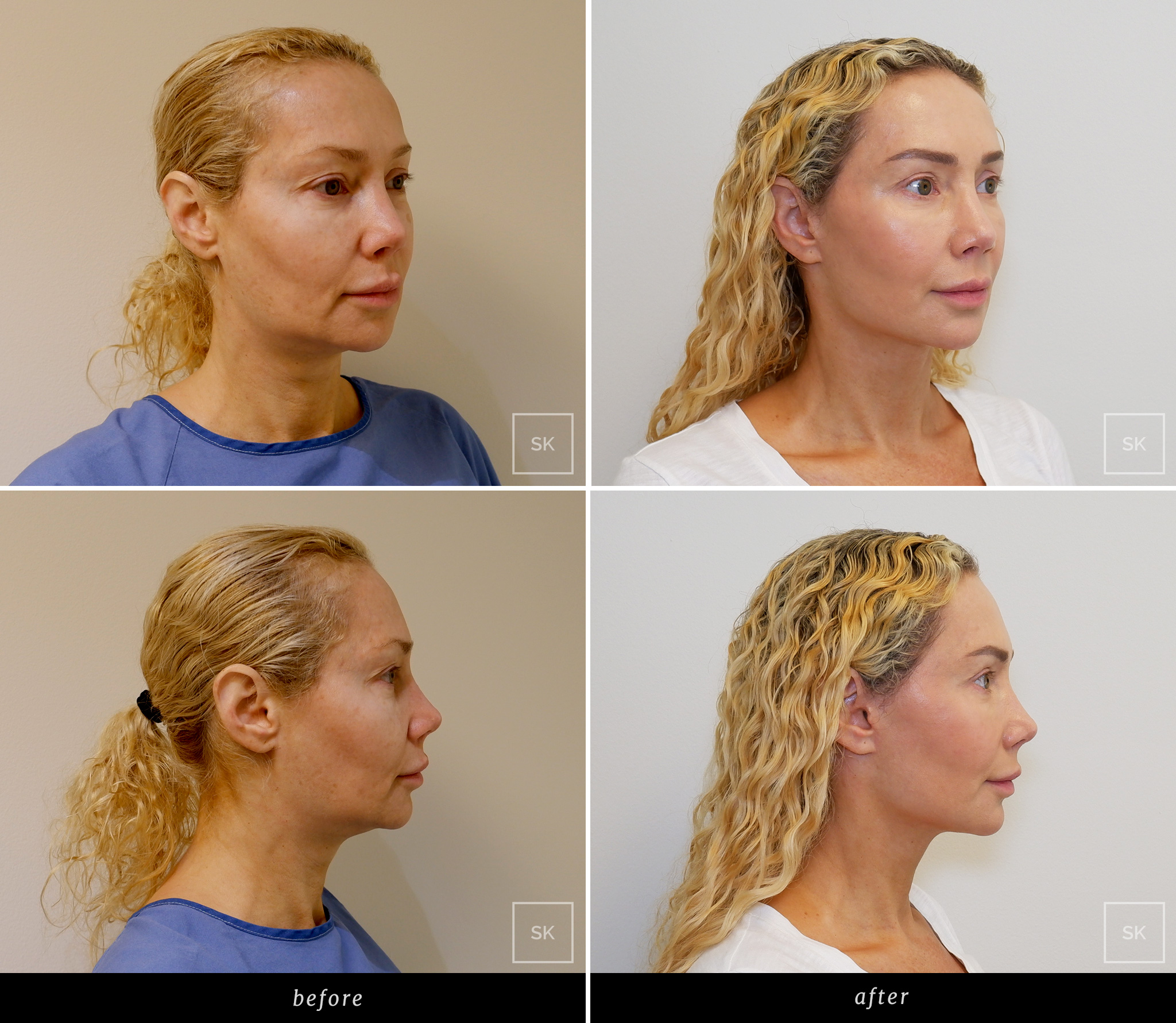 Before & After Photo Gallery