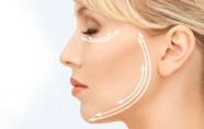 Facelift