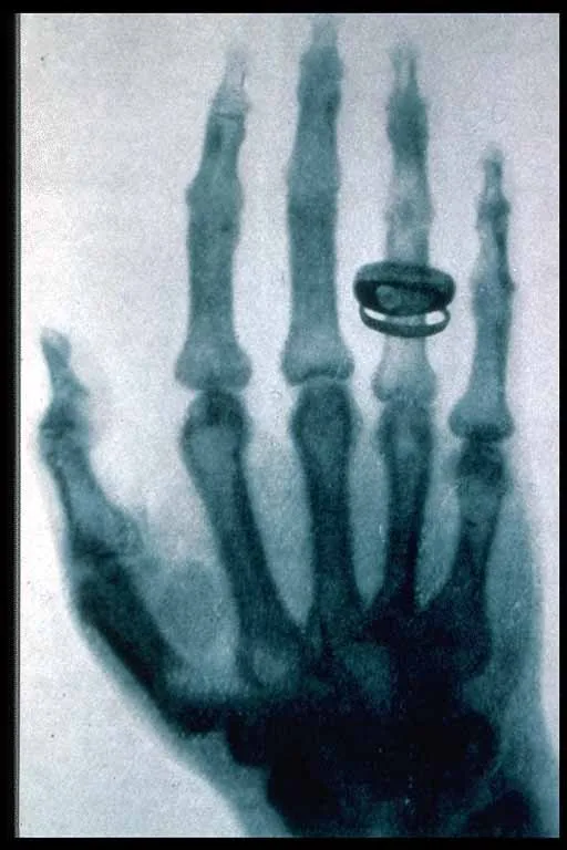 The first X-ray image