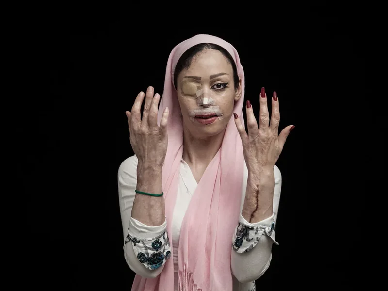 Asghar Khamseh wint Sony World Photography Awards