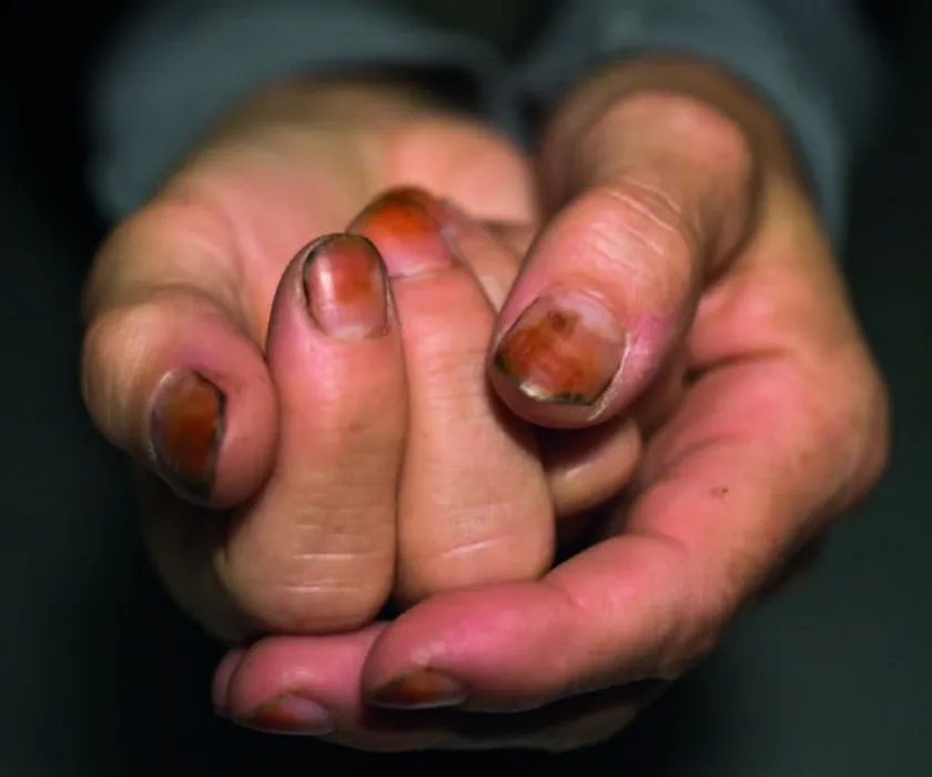 Close-up of photographer Sally Mann's stained hands, photographed by Koos Breukel in 2008.