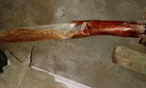 Huíla: Filho atinge mortalmente o pai com ferro
