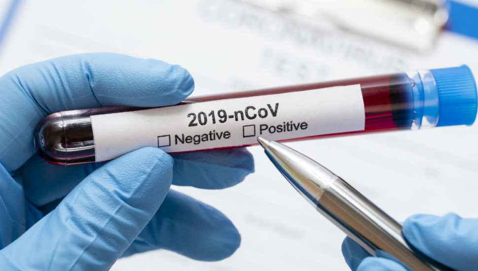 Novo coronavírus é declarado pandemia