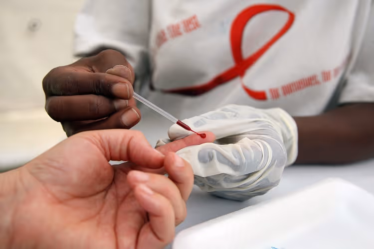 Cunene regista 40 vítimas mortais de HIV no primeiro semestre de 2021