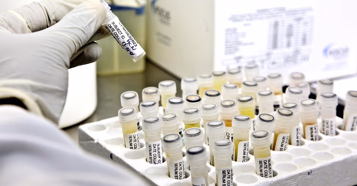 Cientistas no Gabão testam tratamento inovador de dose única contra a malária