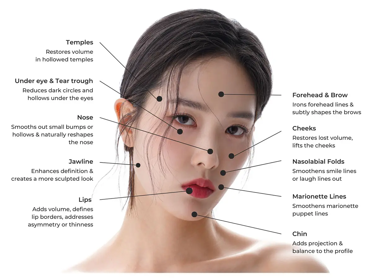Dermal filler facial mapping