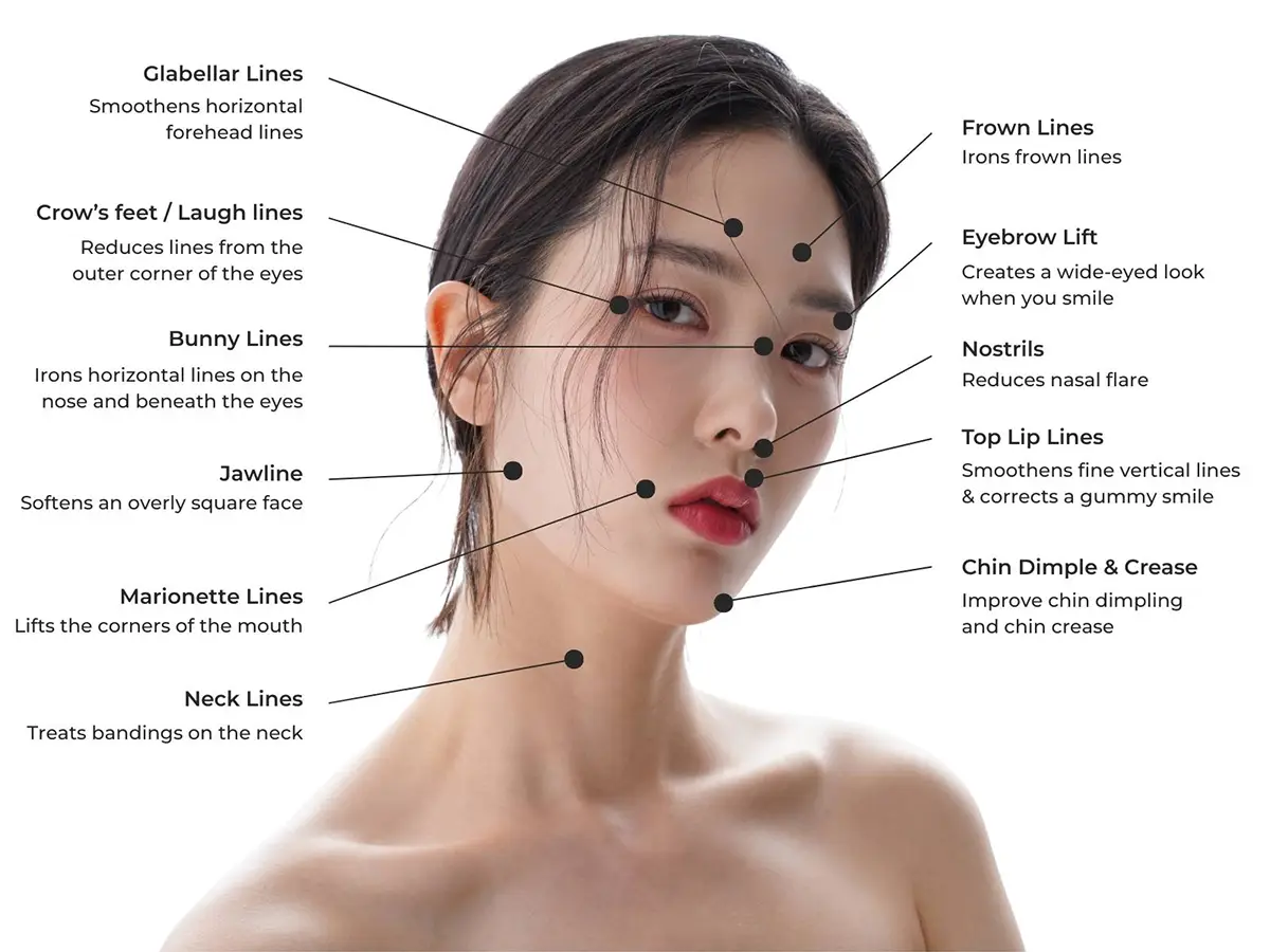 Botulinum toxin injection cosmetic benefits