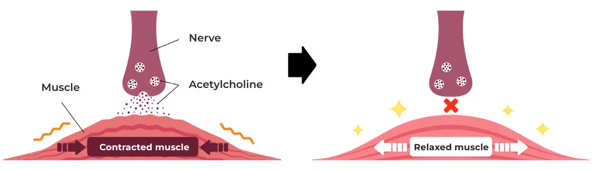 How anti-wrinkle bonta works