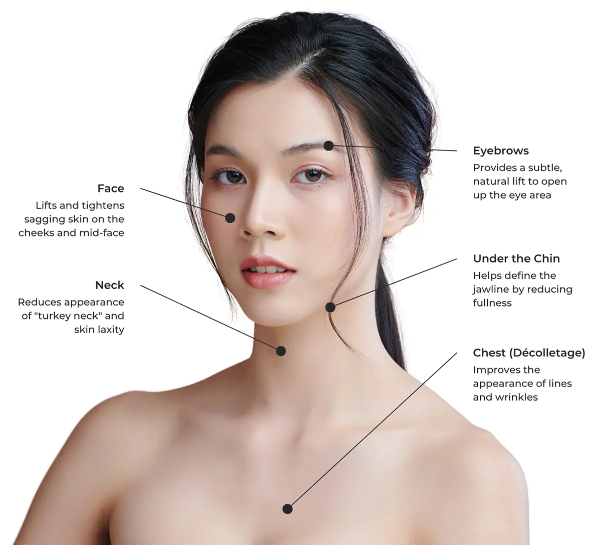 Ultherapy® Prime | Area Mapping 