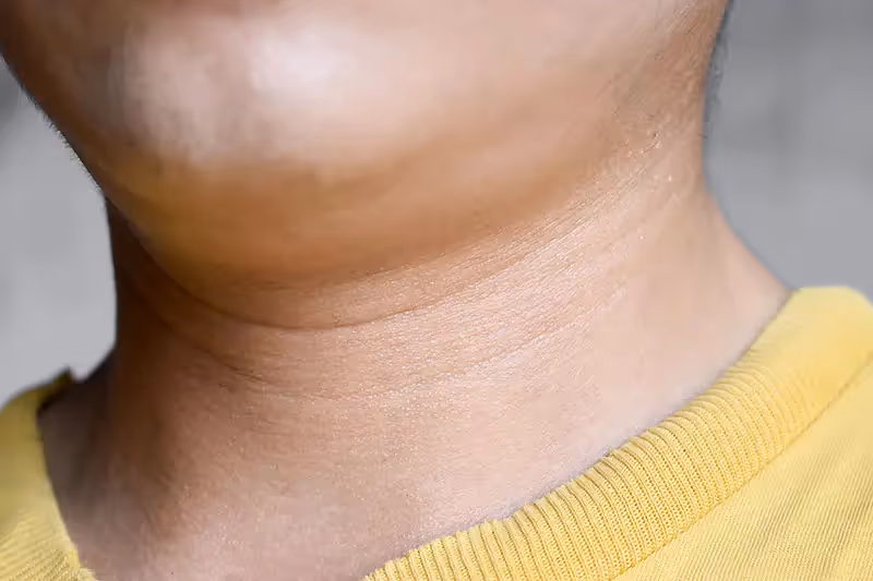 Ring of fat around the neck - is it dangerous?