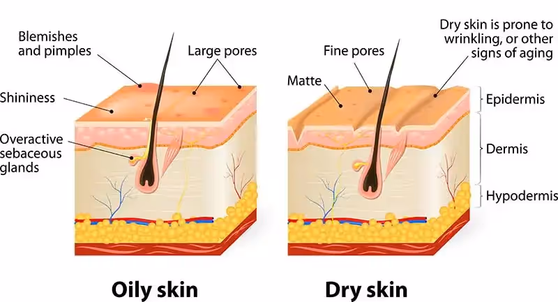 Oily and dry skin Singapore