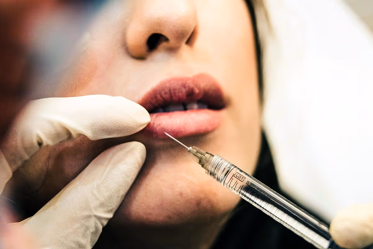 Face tweakment is on the rise, but what happens when you have one too many dermal fillers?