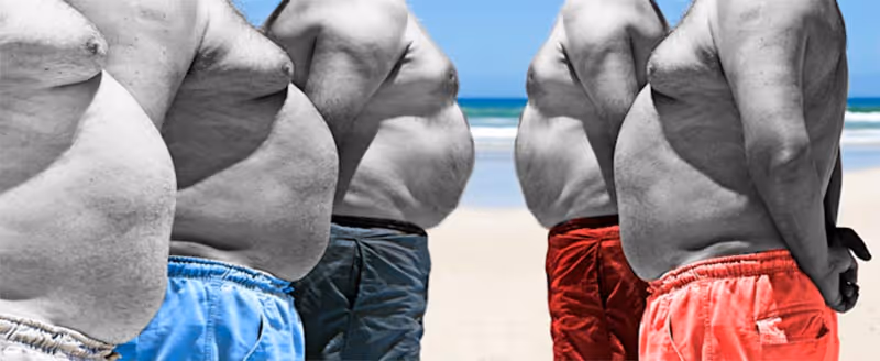 Gynecomastia singapore